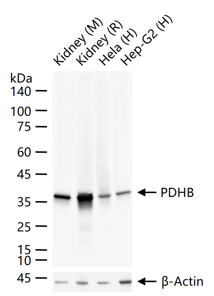 丙酮酸脱氢酶E1β亚单位重组兔单抗