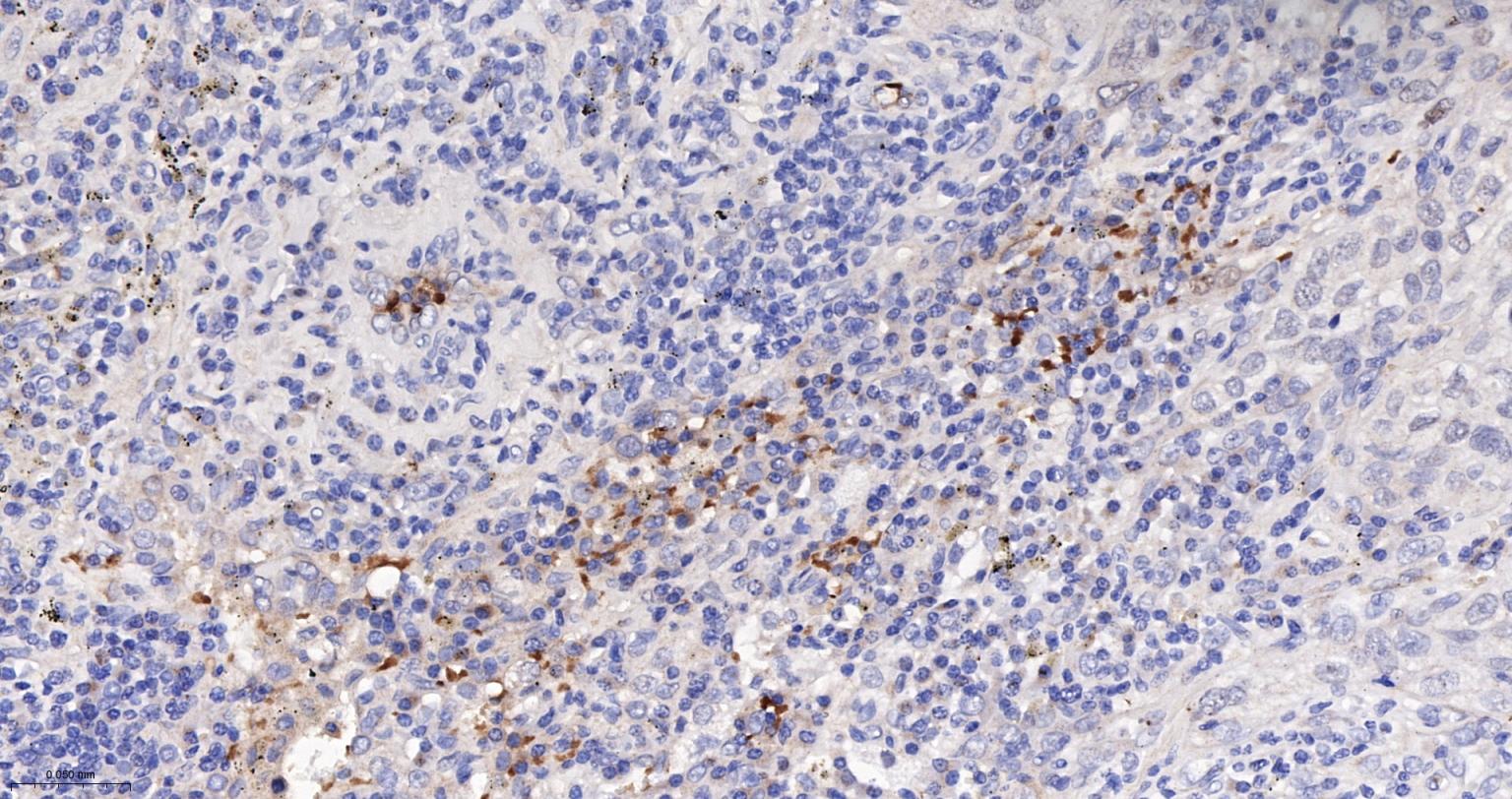 一氧化氮合成酶-2（诱导型）抗体-bs-0162R