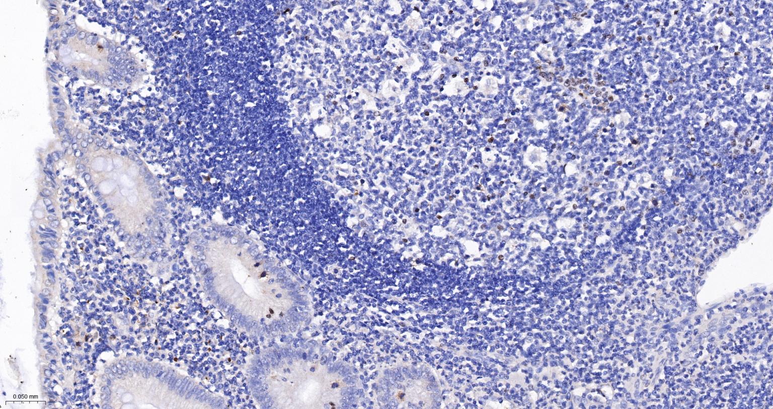 一氧化氮合成酶-2（诱导型）抗体-bs-0162R