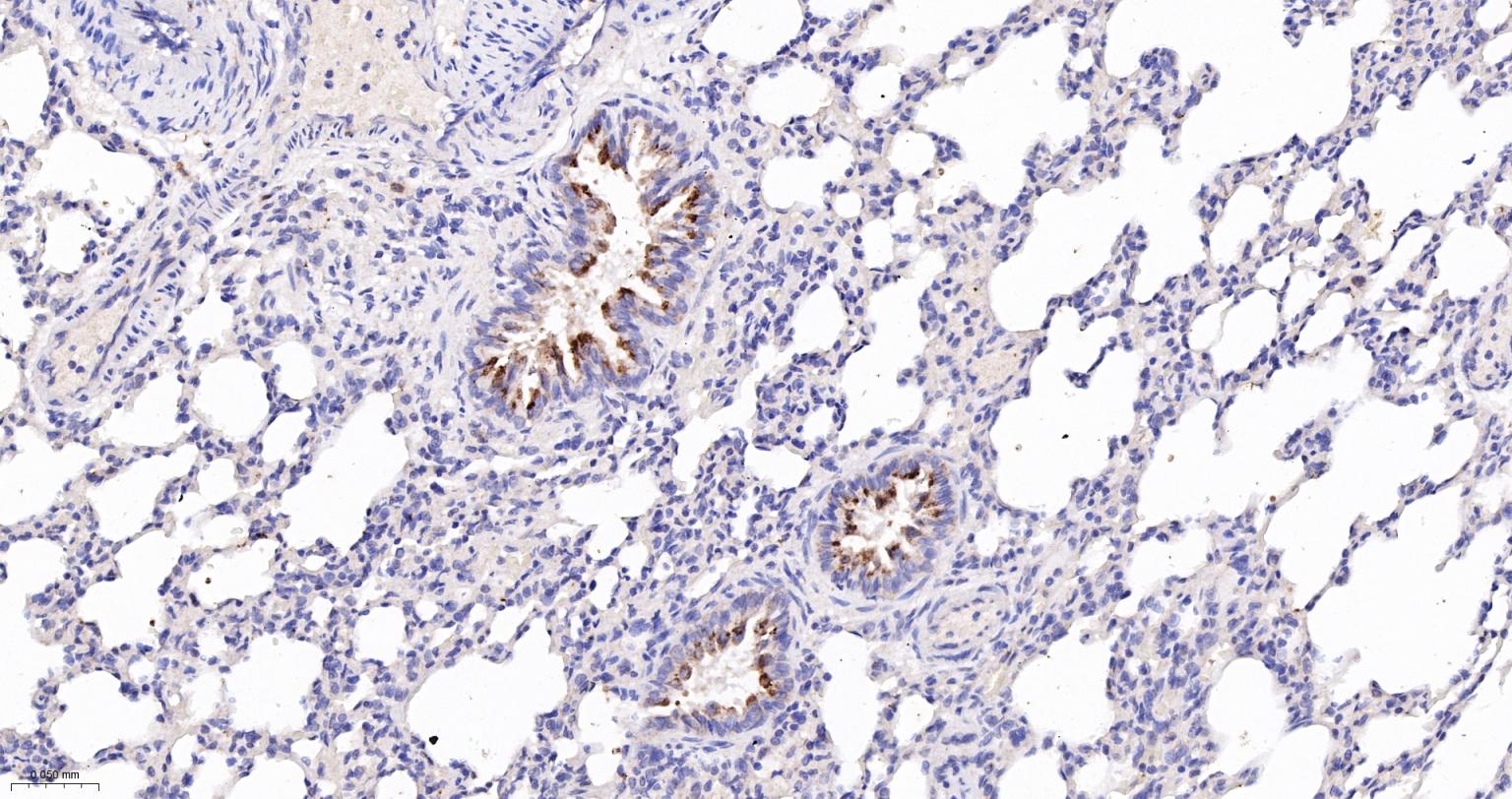 一氧化氮合成酶-2（诱导型）抗体-bs-0162R