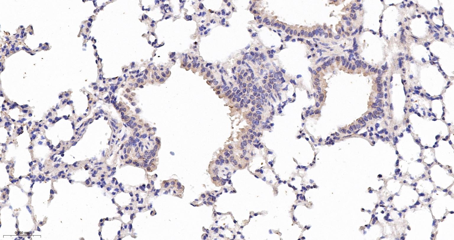 一氧化氮合成酶-2（诱导型）抗体-bs-0162R