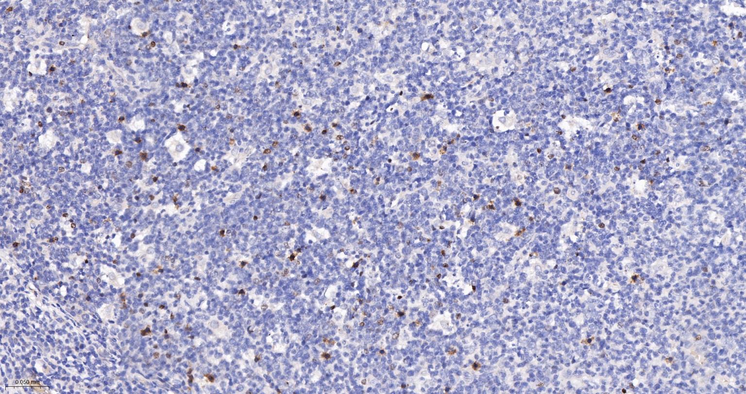 一氧化氮合成酶-2（诱导型）抗体-bs-0162R