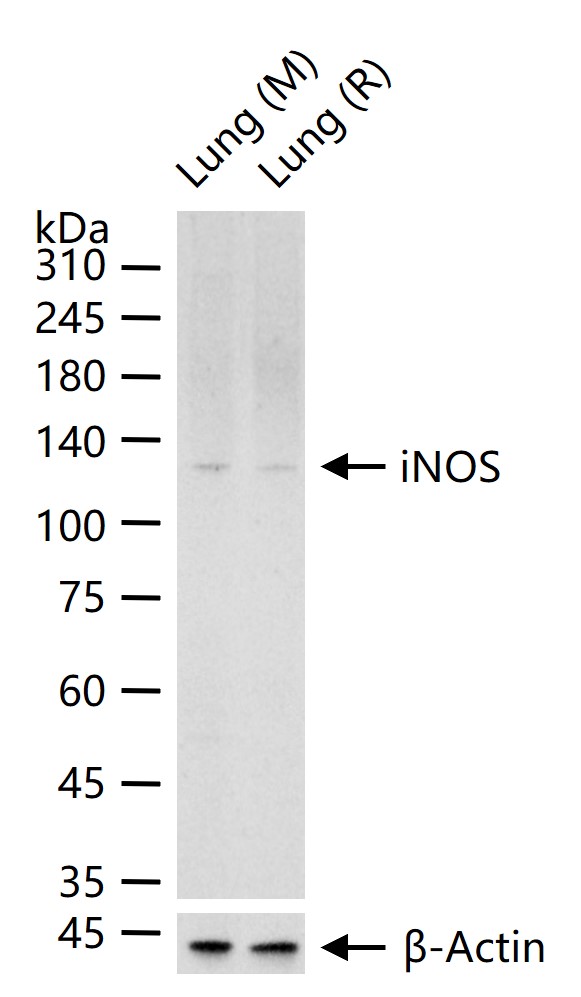 NOS2/iNOS Rabbit pAb (一抗) - WB,IHC-P,IHC-F,IF,ELISA | Bioss