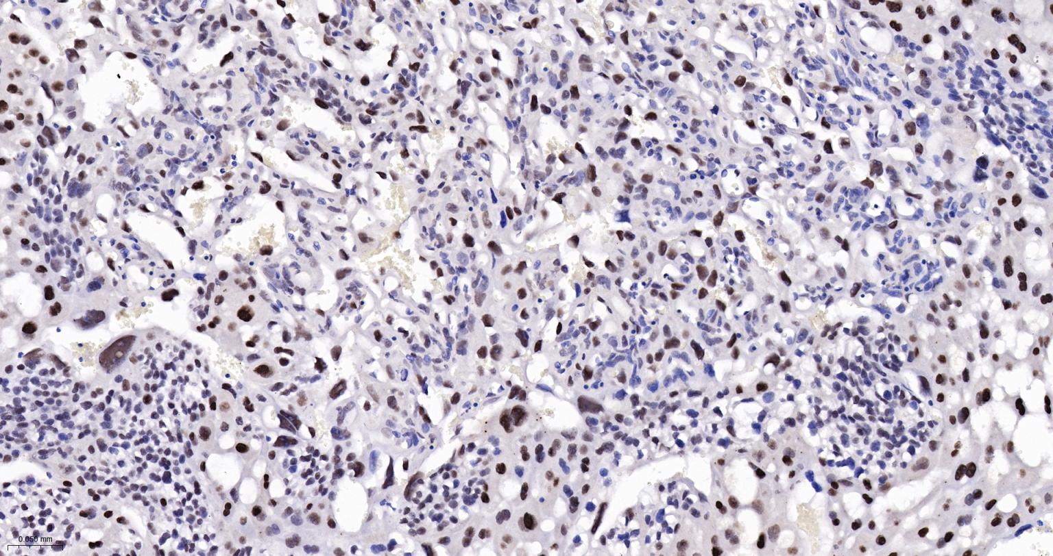 DNA甲基转移酶-3α重组兔单抗