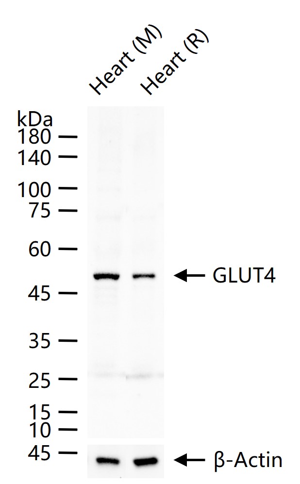 GLUT4 Rabbit pAb (一抗) - WB | Bioss