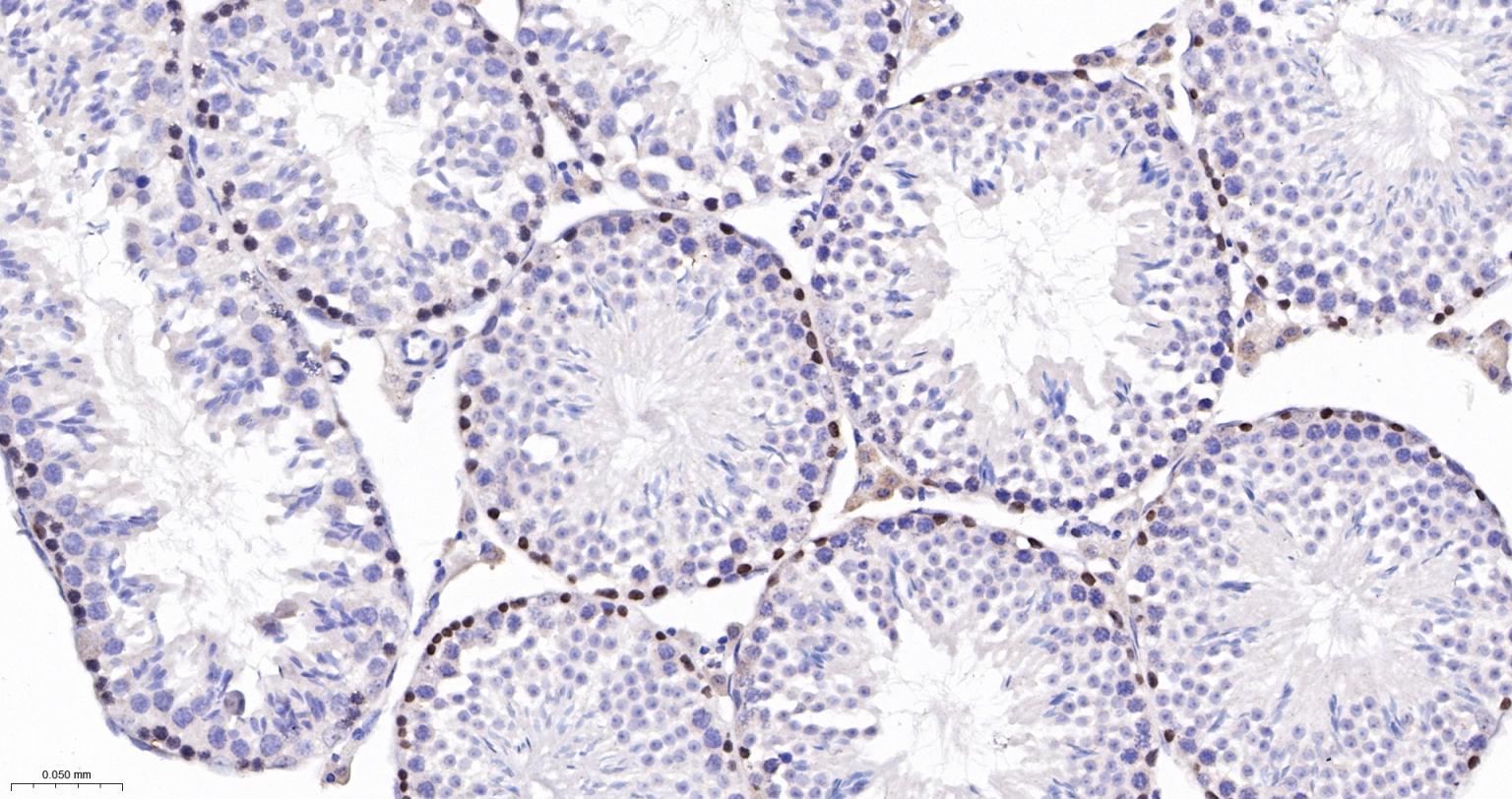 DNA甲基转移酶-3α重组兔单抗