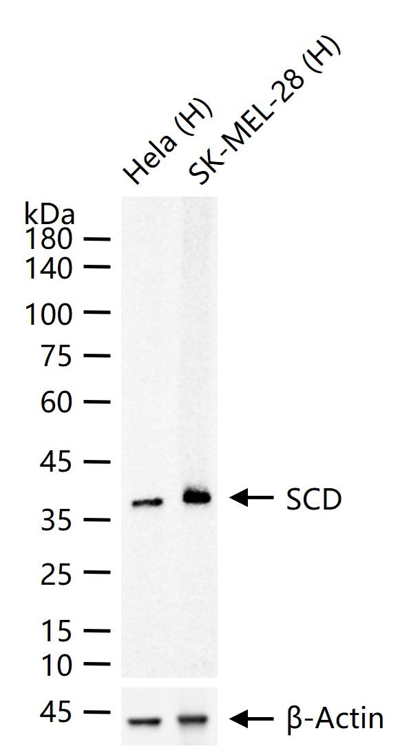 固醇酰辅酶A脱氢酶1抗体-bs-55193R
