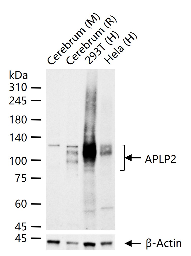 APLP2 Recombinant Rabbit mAb (一抗) - WB,IHC-P,IHC-F,IF,Flow-Cyt | Bioss