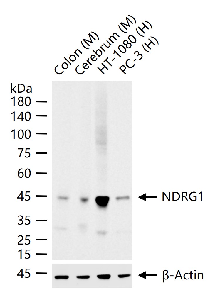 分化相关基因NDRG1重组兔单抗