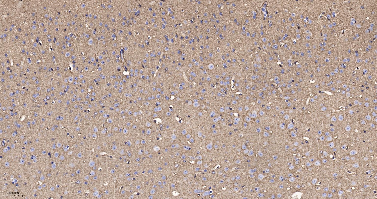 胶质细胞谷氨酸运载蛋白1重组兔单抗