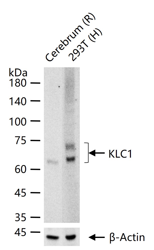 KLC1 Recombinant Rabbit mAb (一抗) - WB,IHC-P,IHC-F,IF,Flow-Cyt,IP | Bioss