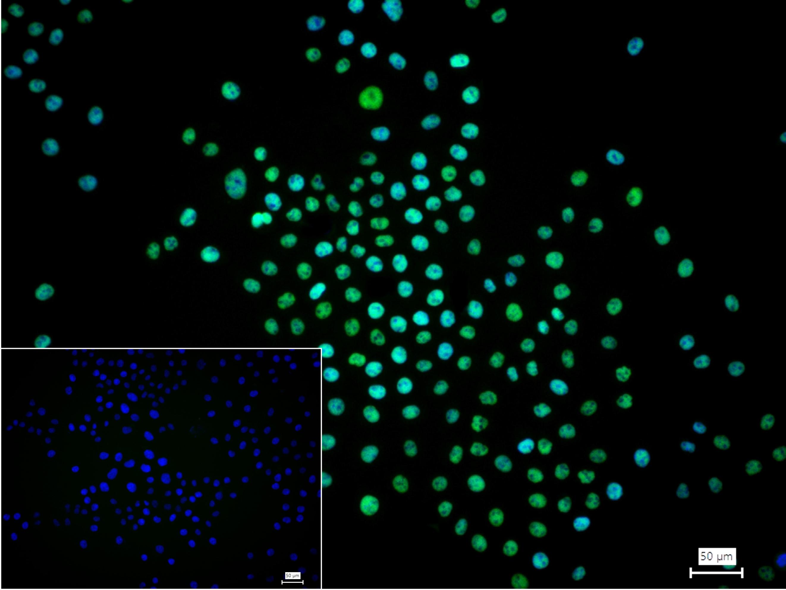 染色体结构维持蛋白质1α重组兔单抗