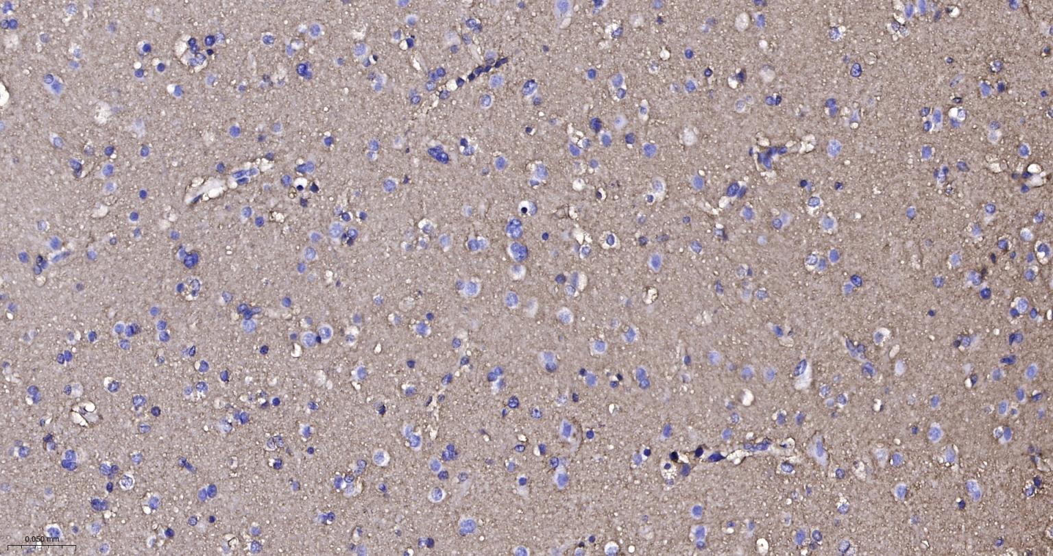 胶质细胞谷氨酸运载蛋白1重组兔单抗