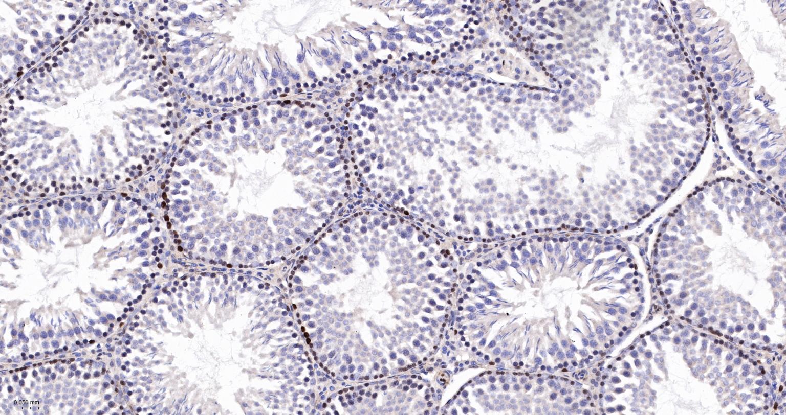 DNA甲基转移酶-3α重组兔单抗