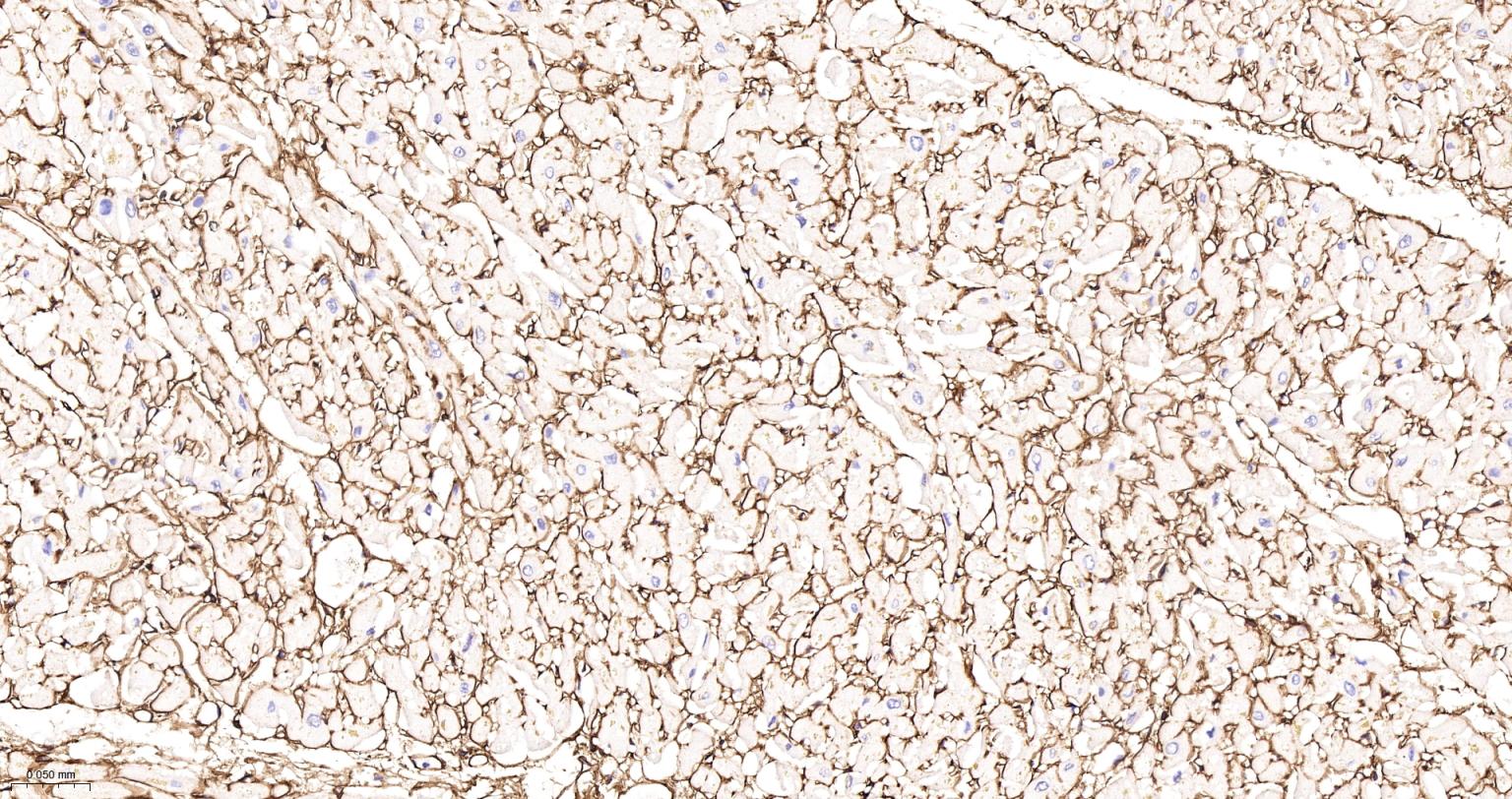 6型胶原重组兔单抗