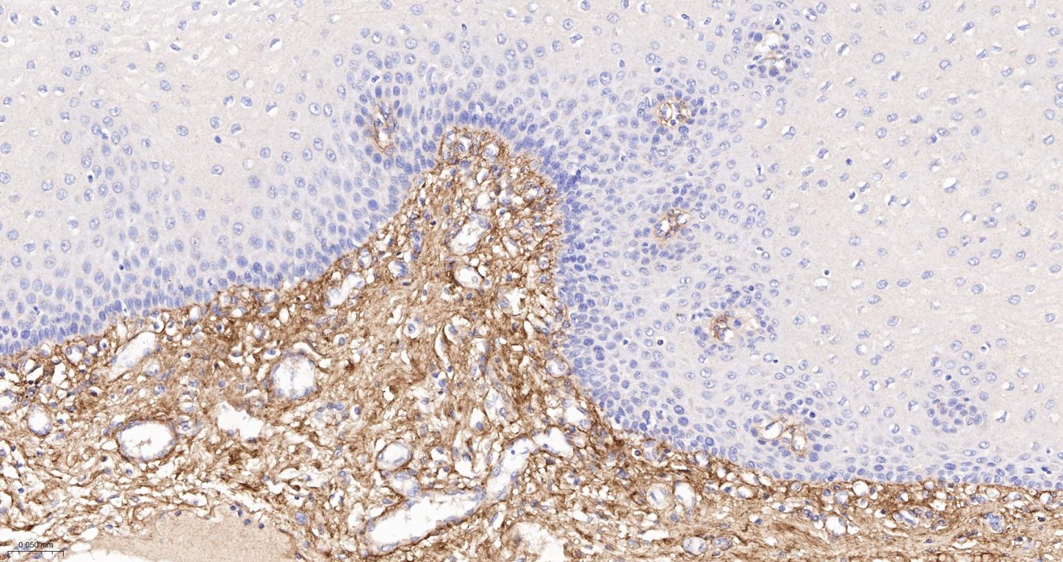 6型胶原重组兔单抗