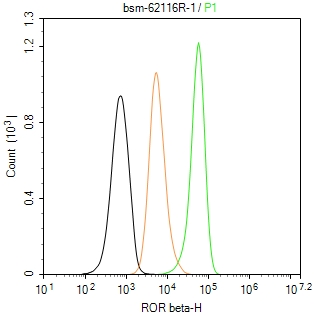 维甲酸相关孤儿受体β重组兔单抗-bsm-62116R