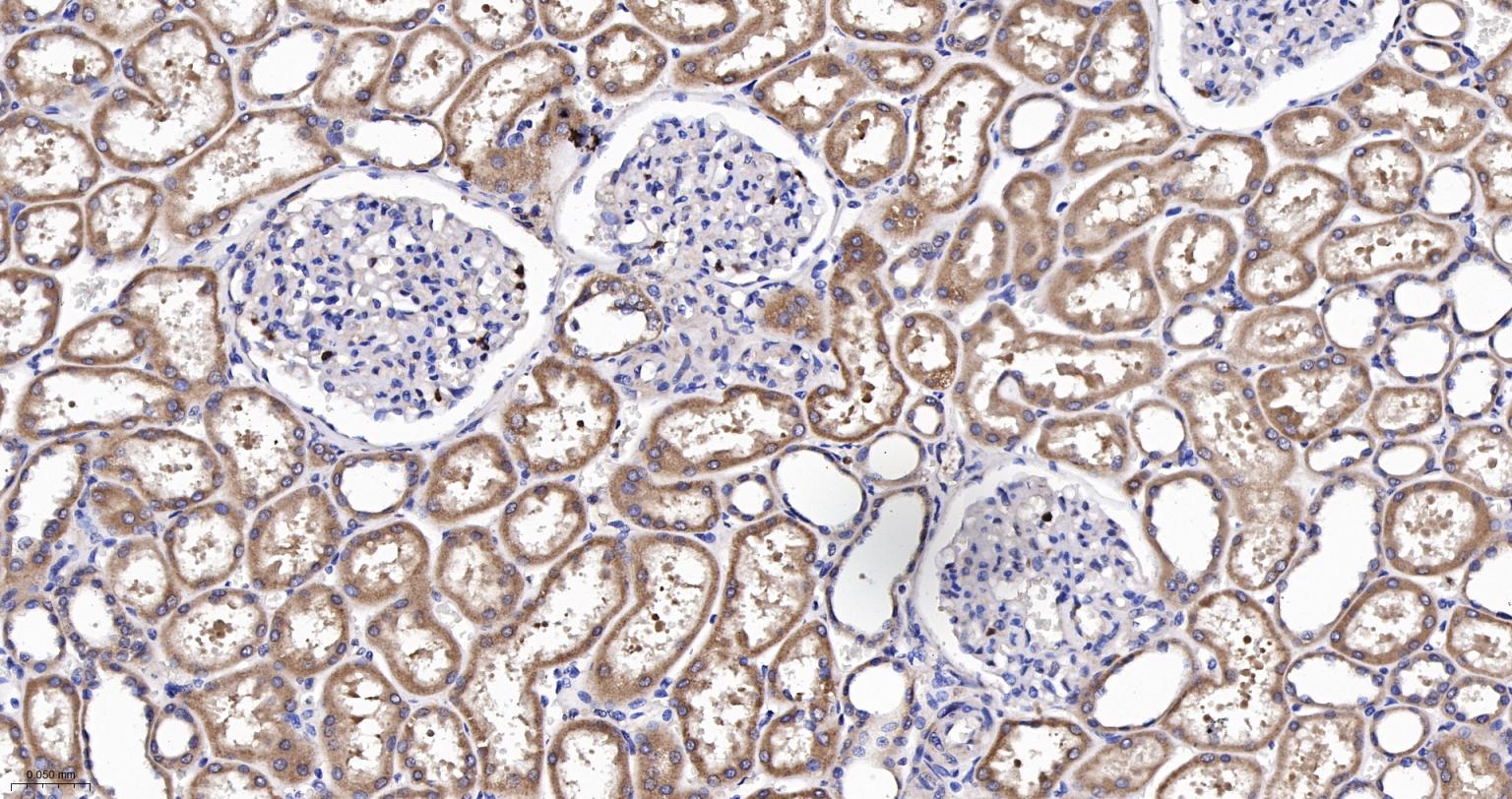 前列腺分泌蛋白重组兔单抗