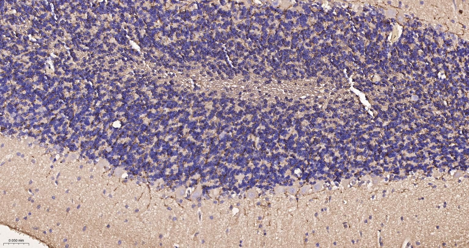 髓鞘碱性蛋白/磷脂碱性蛋白重组兔单抗