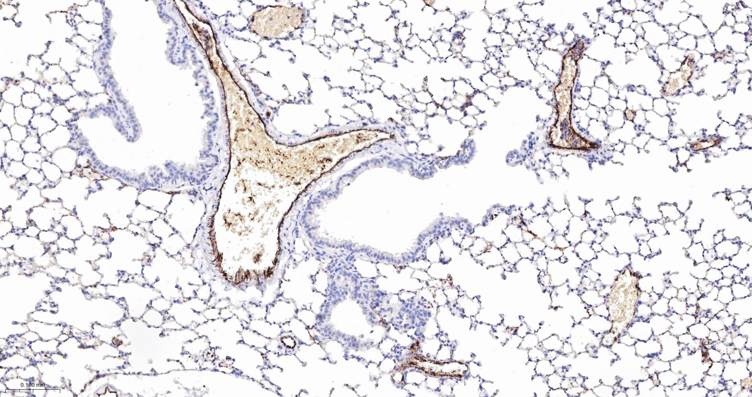 血管假性血友病因子重组兔单抗