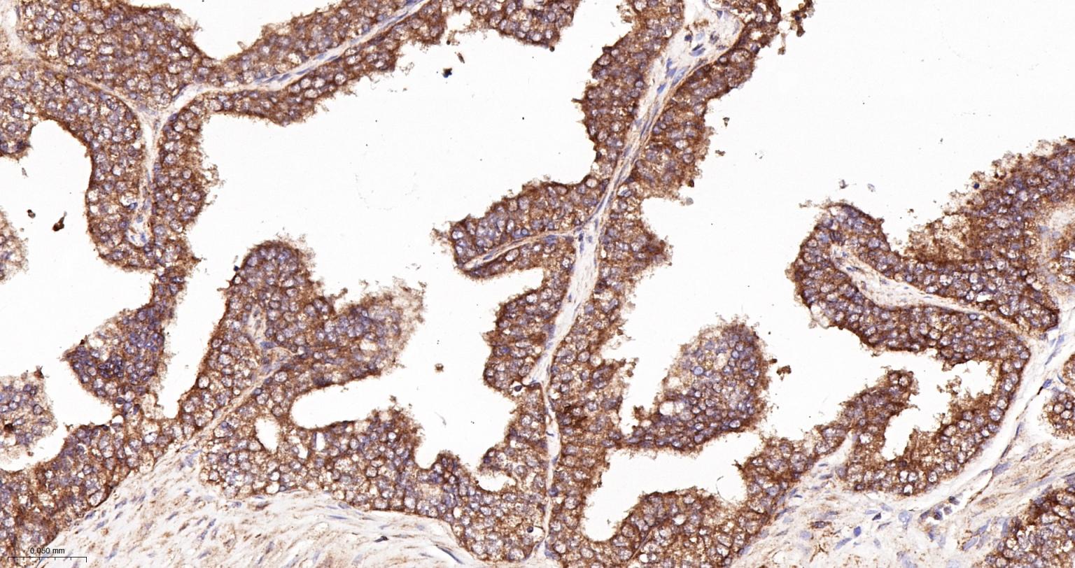 肌动蛋白相关蛋白2重组兔单抗
