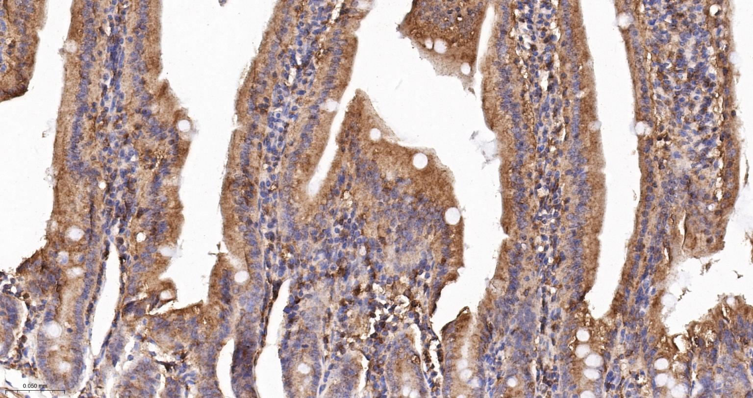 肌动蛋白相关蛋白2重组兔单抗