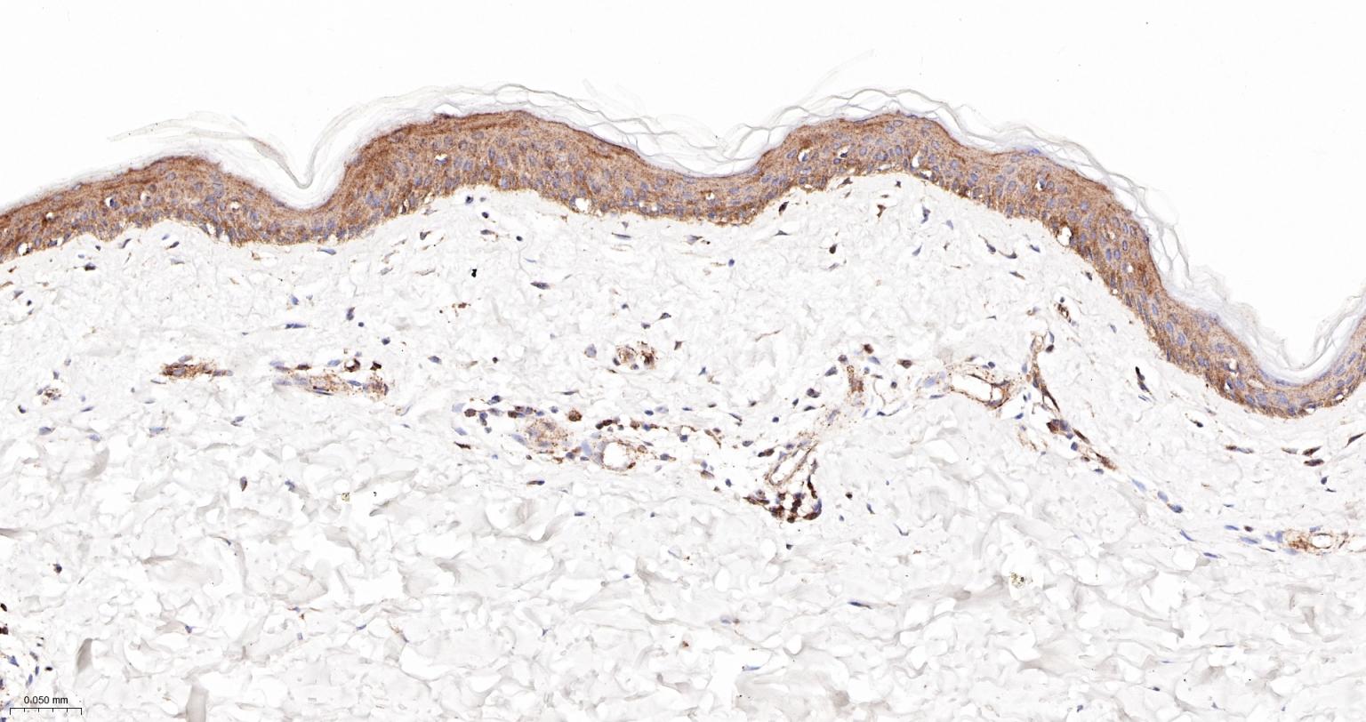 肌动蛋白相关蛋白2重组兔单抗