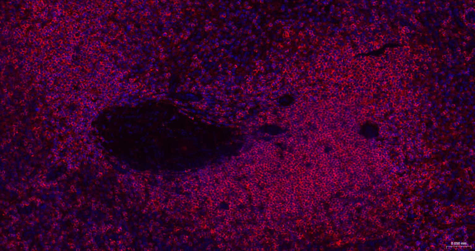 白细胞共同抗原CD45重组兔单抗