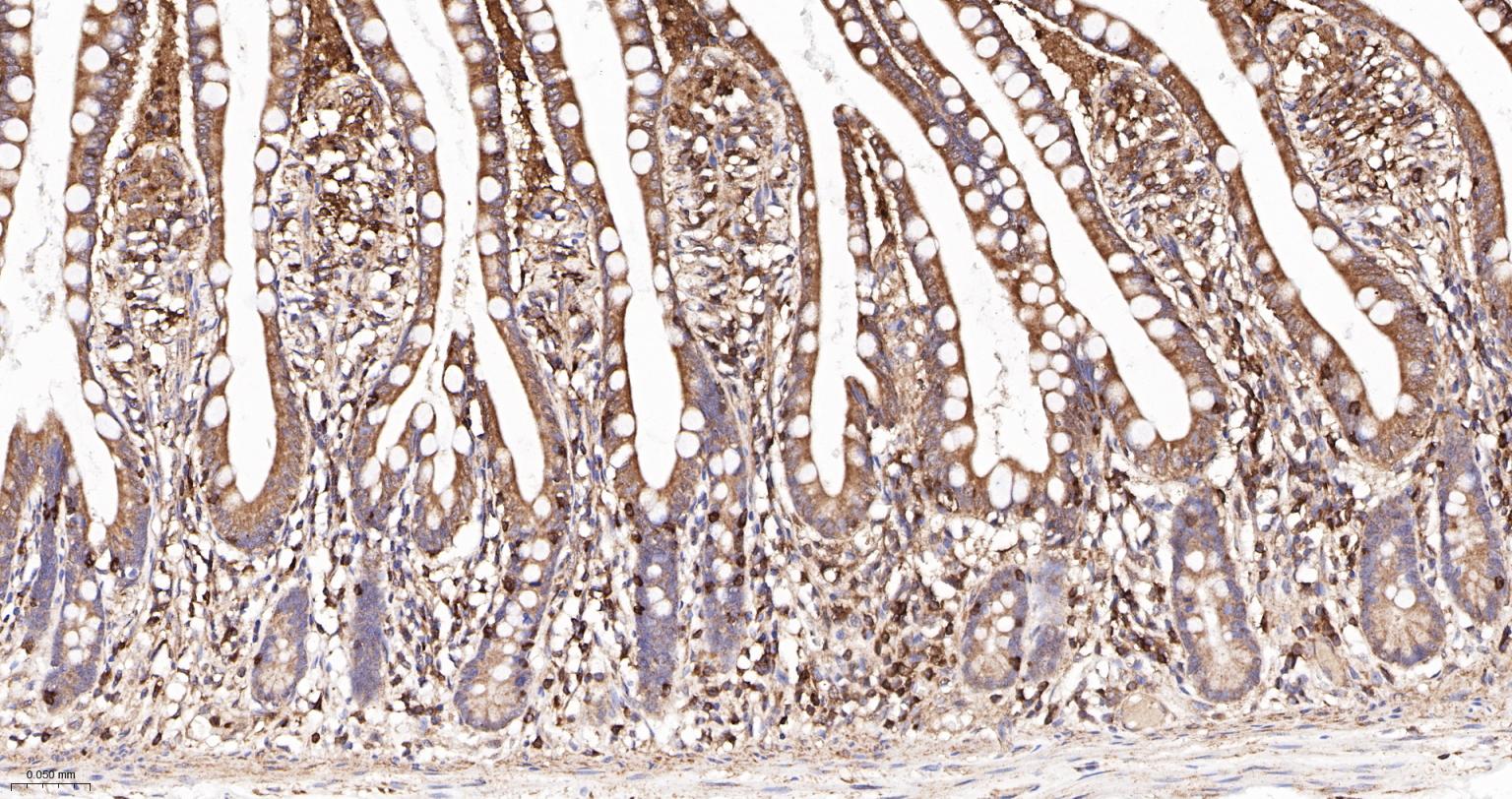 肌动蛋白相关蛋白2重组兔单抗