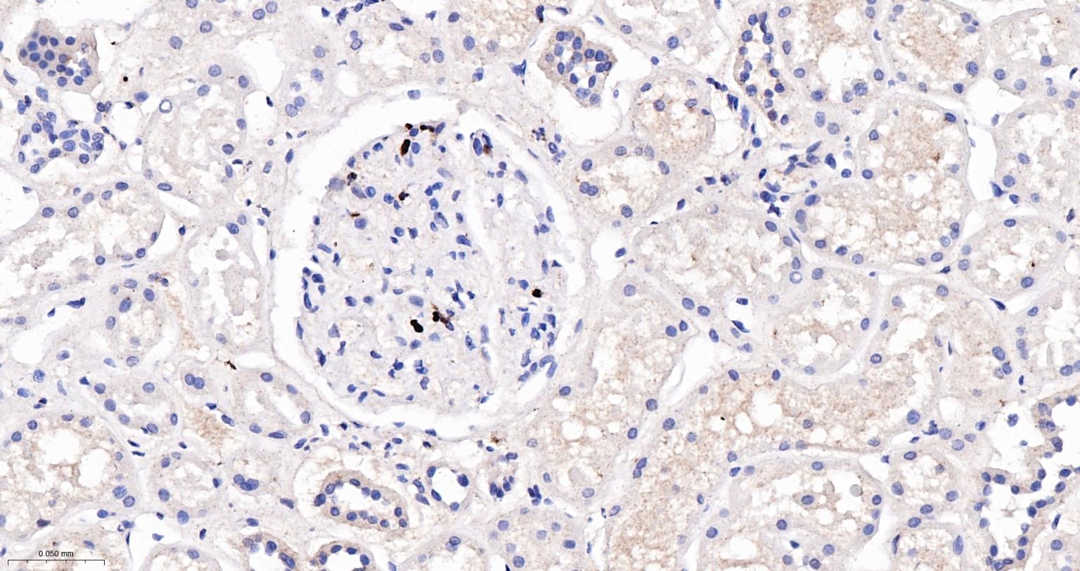 瓜氨酸组蛋白3重组兔单抗