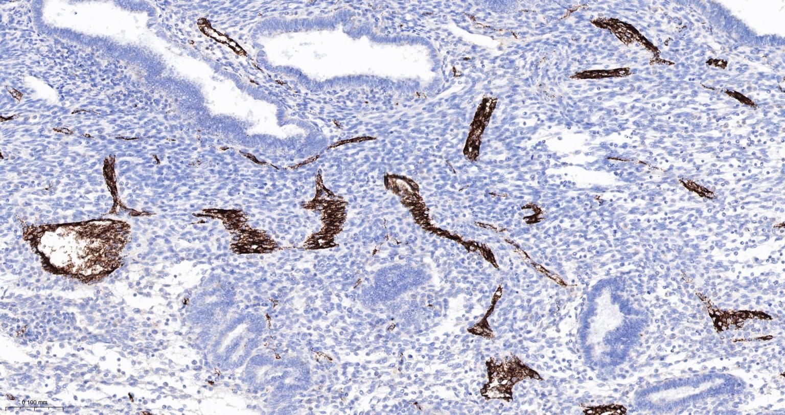 血管假性血友病因子重组兔单抗
