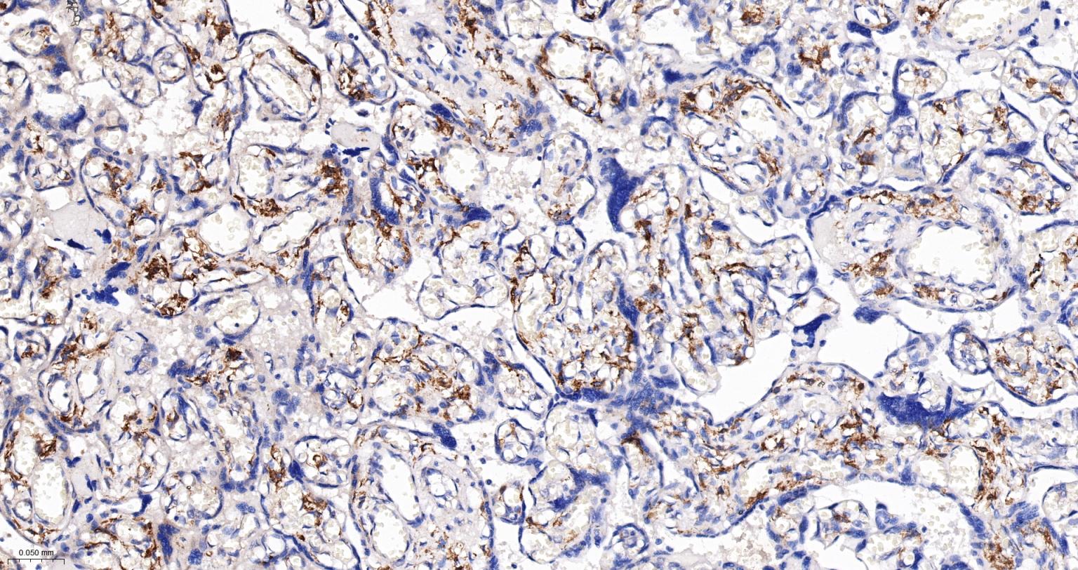 白介素1β/IL-1β抗体-bs-0812R