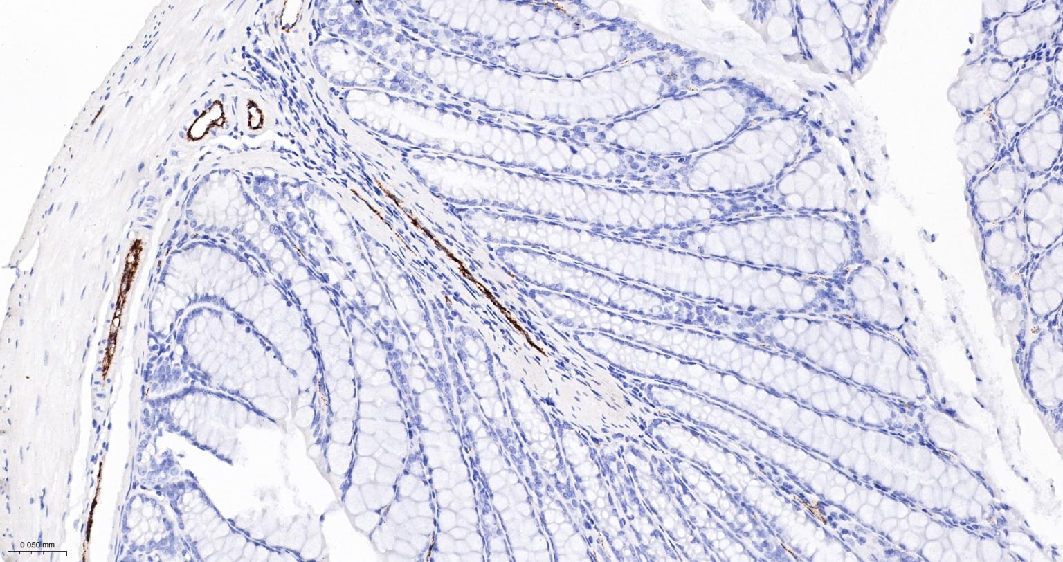 血管假性血友病因子重组兔单抗