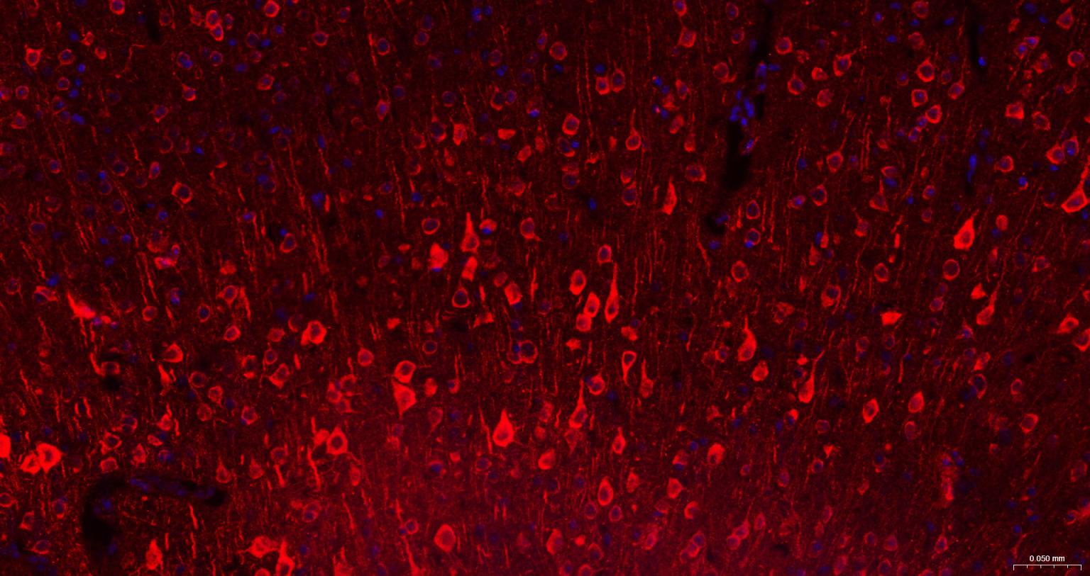 高分子量神经丝蛋白抗体