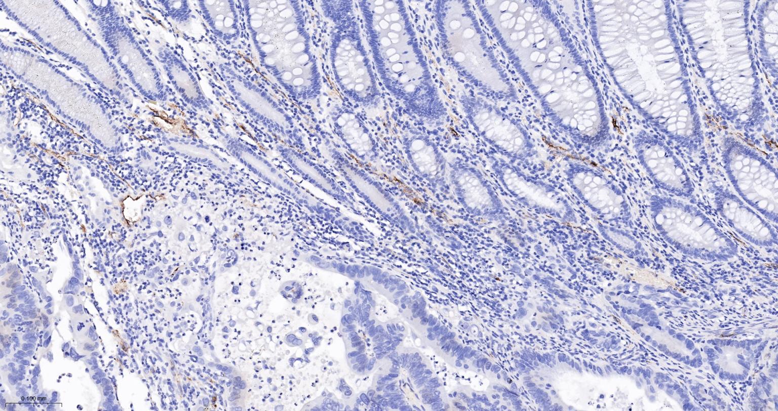 血管假性血友病因子重组兔单抗