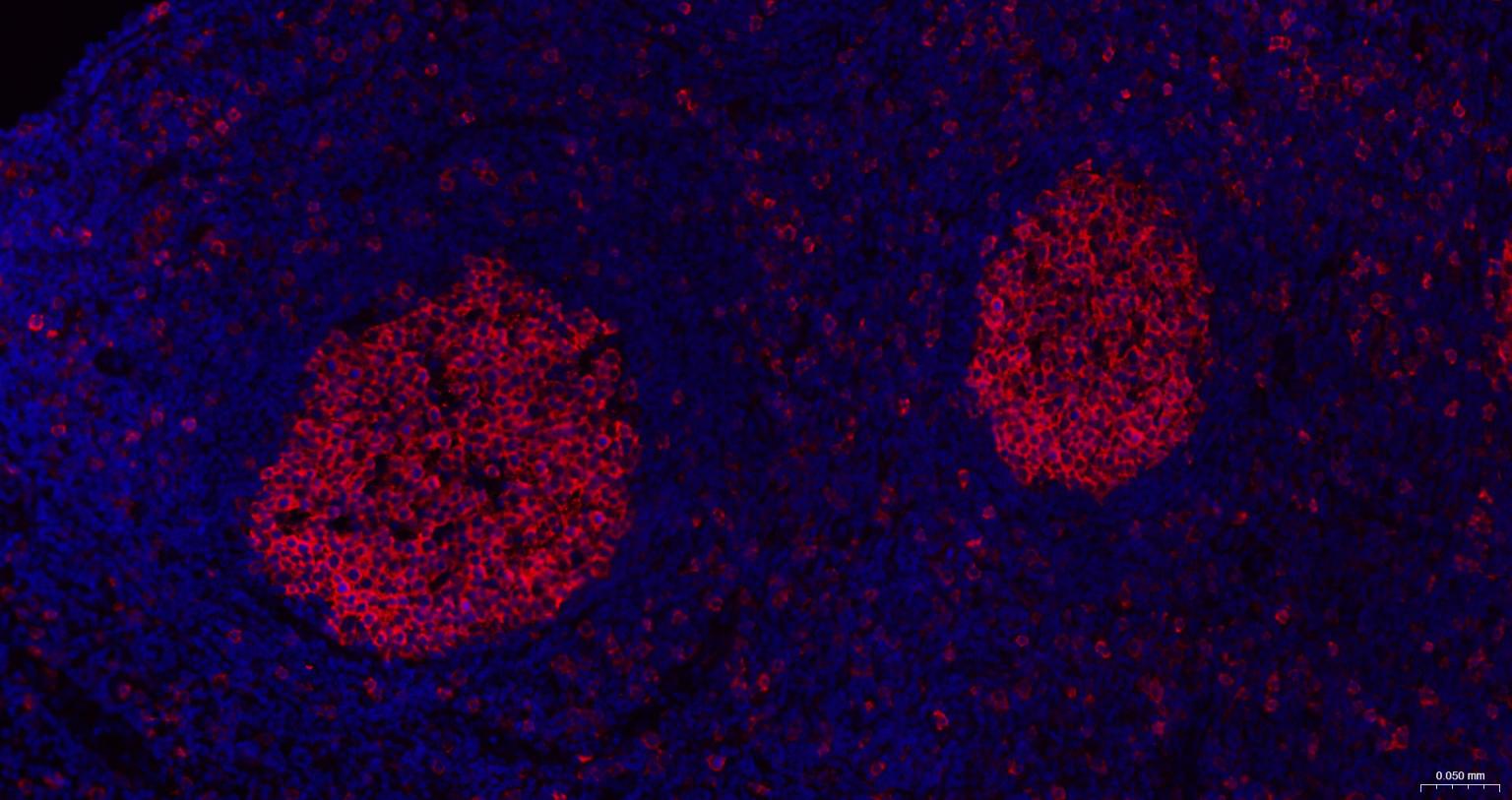 白血病相关蛋白18/癌蛋白18重组兔单抗