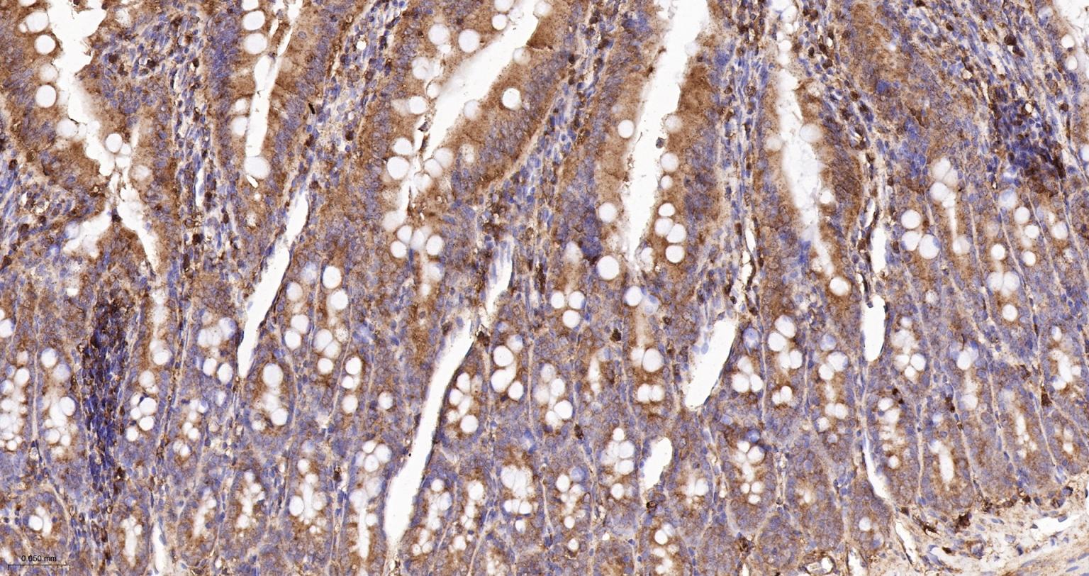 肌动蛋白相关蛋白2重组兔单抗