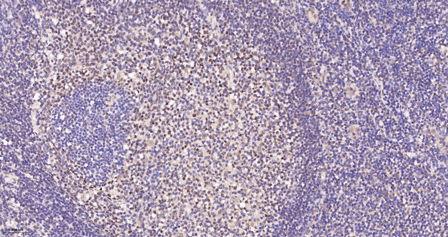 端粒结合蛋白2重组兔单抗