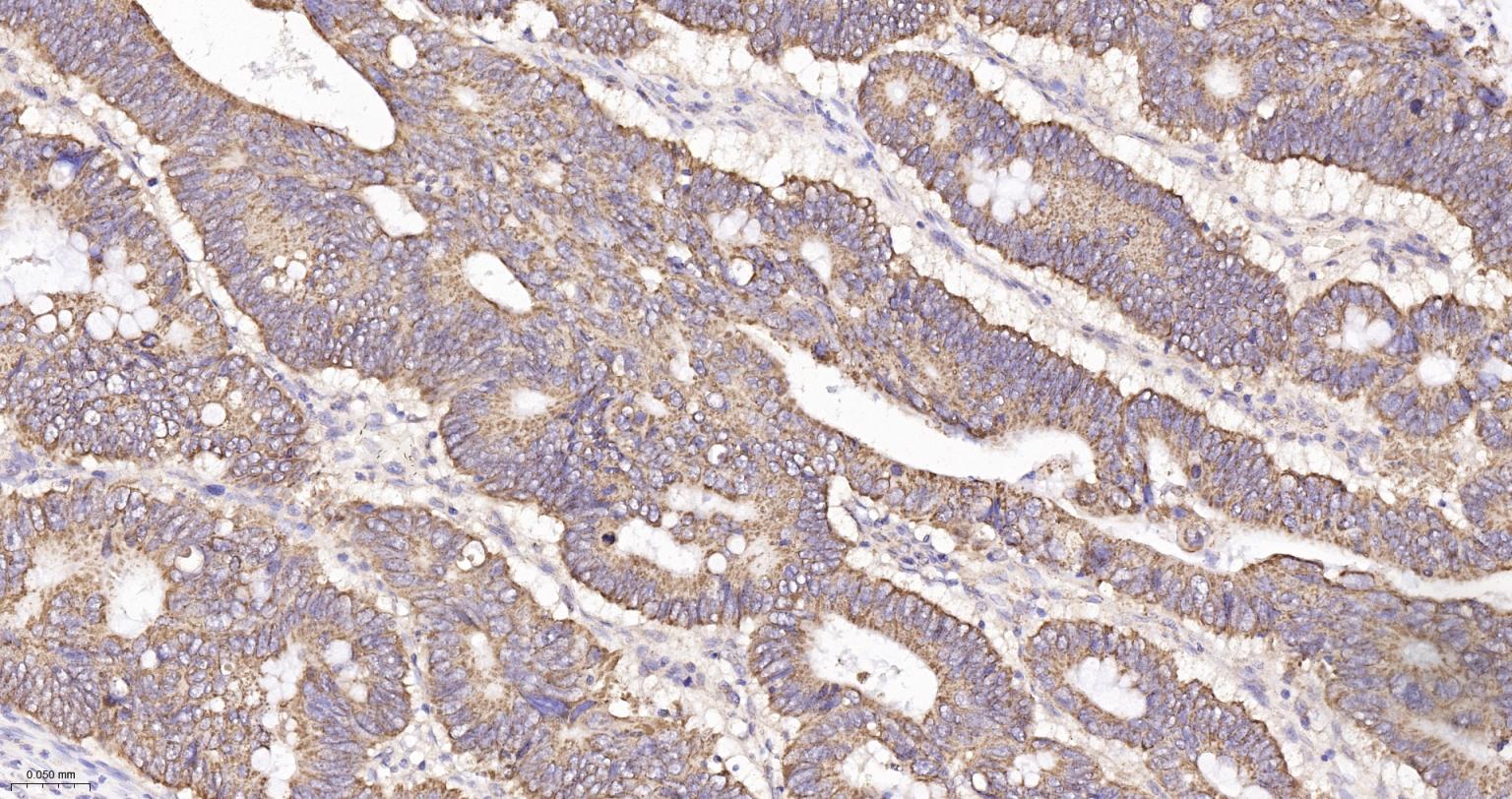 线粒体异柠檬酸脱氢酶重组兔单抗