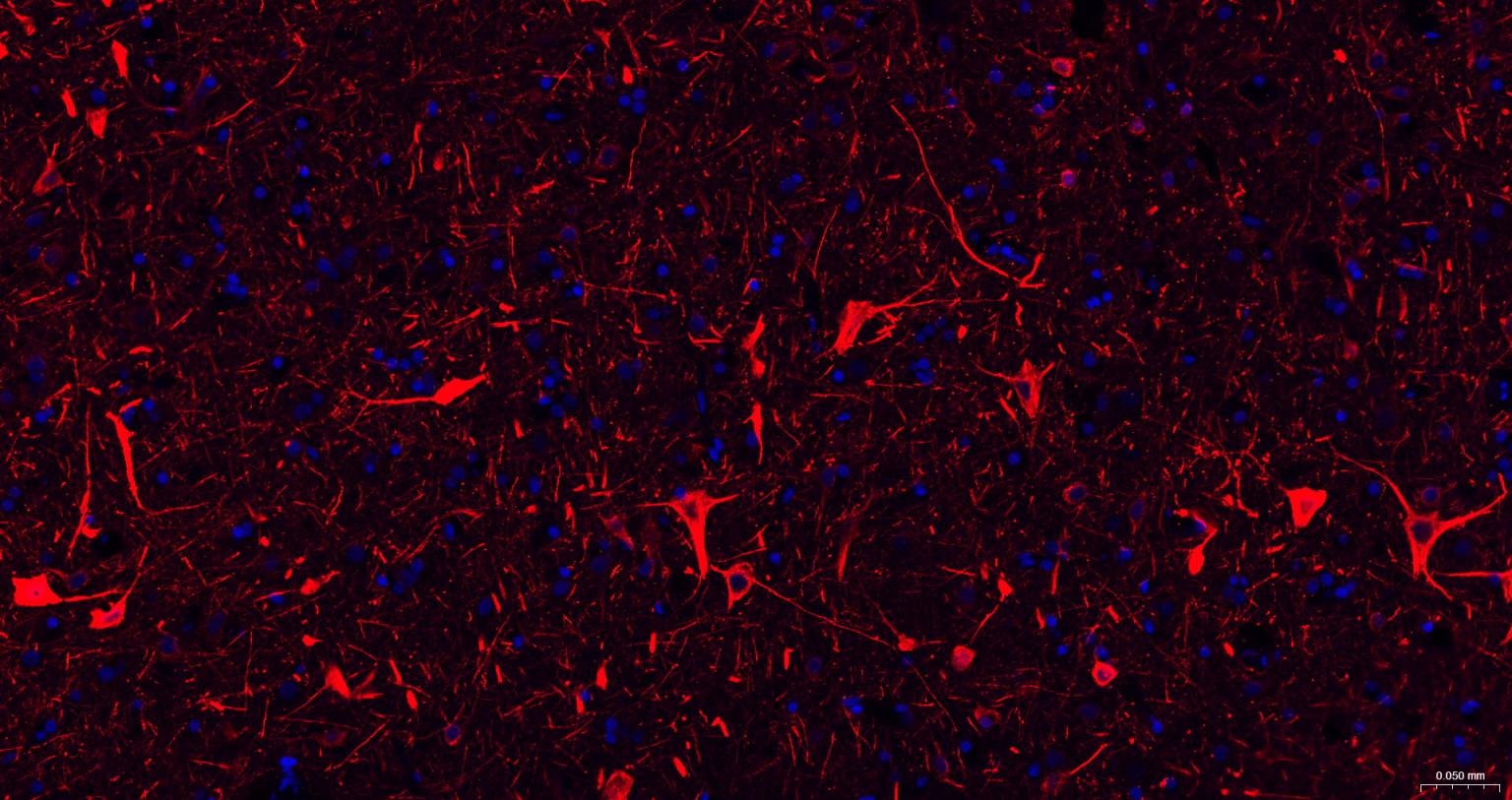 高分子量神经丝蛋白抗体
