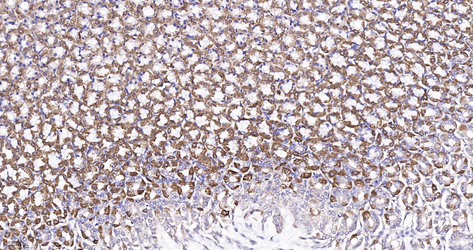 线粒体异柠檬酸脱氢酶重组兔单抗