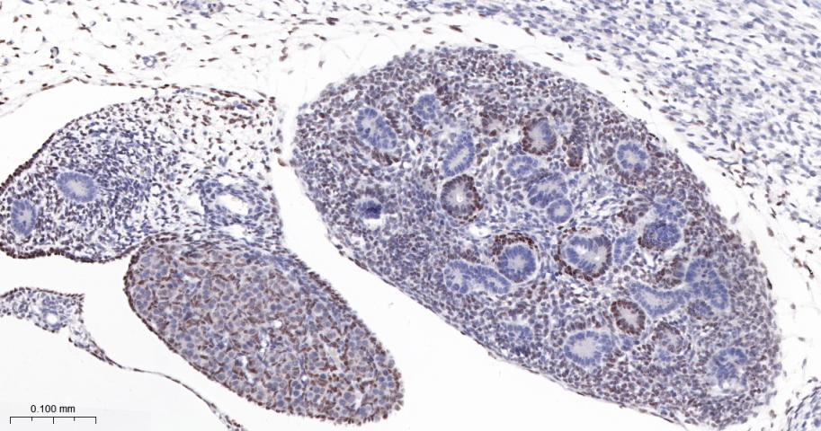 肾母细胞瘤蛋白重组兔单抗