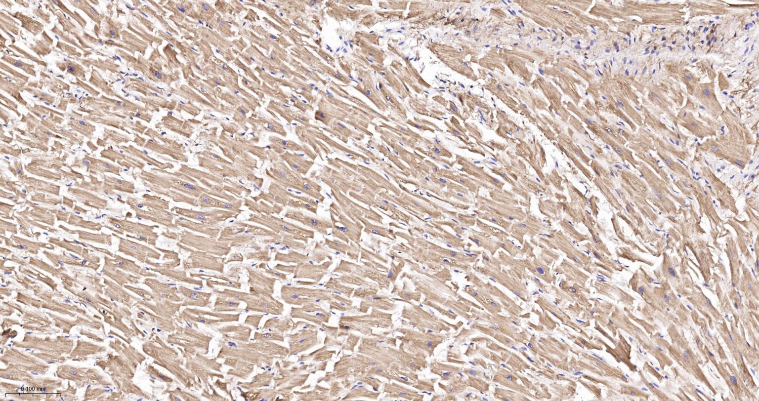 线粒体异柠檬酸脱氢酶重组兔单抗
