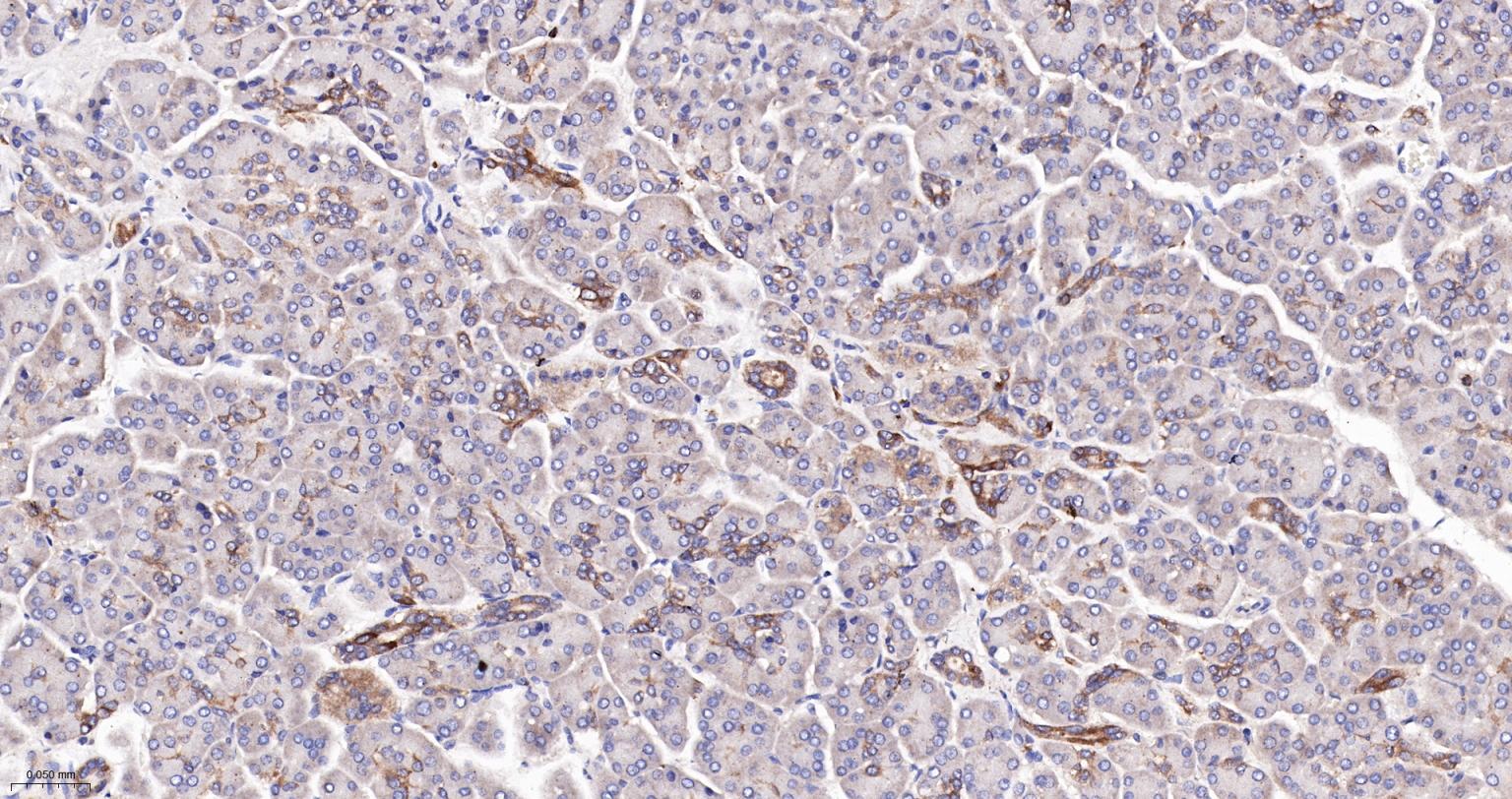 核因子κB抑制蛋白E重组兔单抗