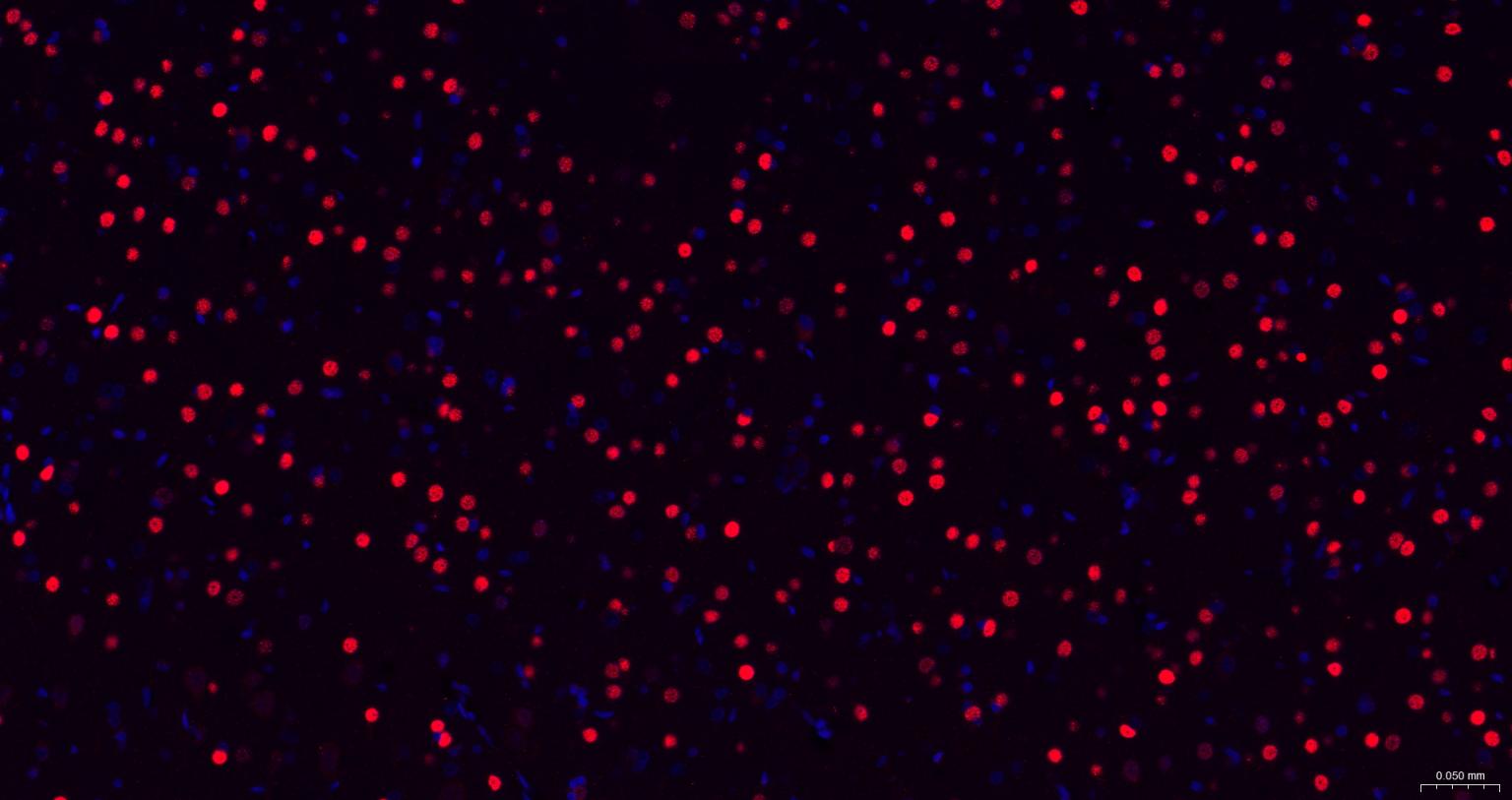 TBR1蛋白重组兔单抗