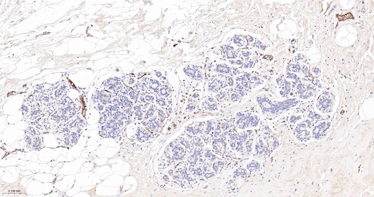 血管假性血友病因子重组兔单抗