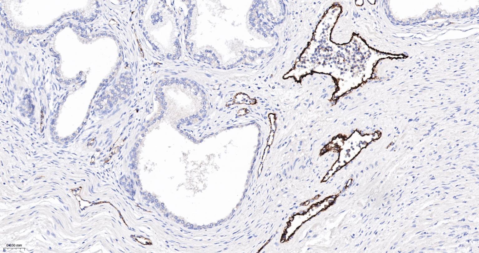 血管假性血友病因子重组兔单抗