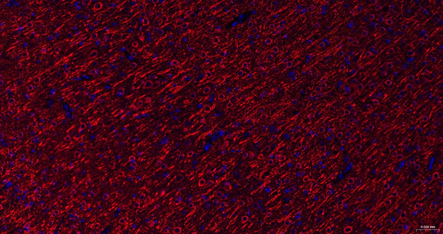 磷酸化微管相关蛋白2重组兔单抗-bsm-62863R