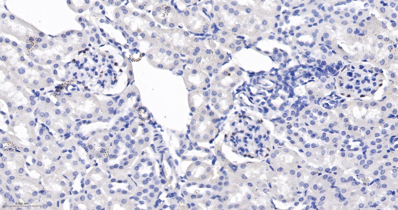 肾母细胞瘤蛋白重组兔单抗
