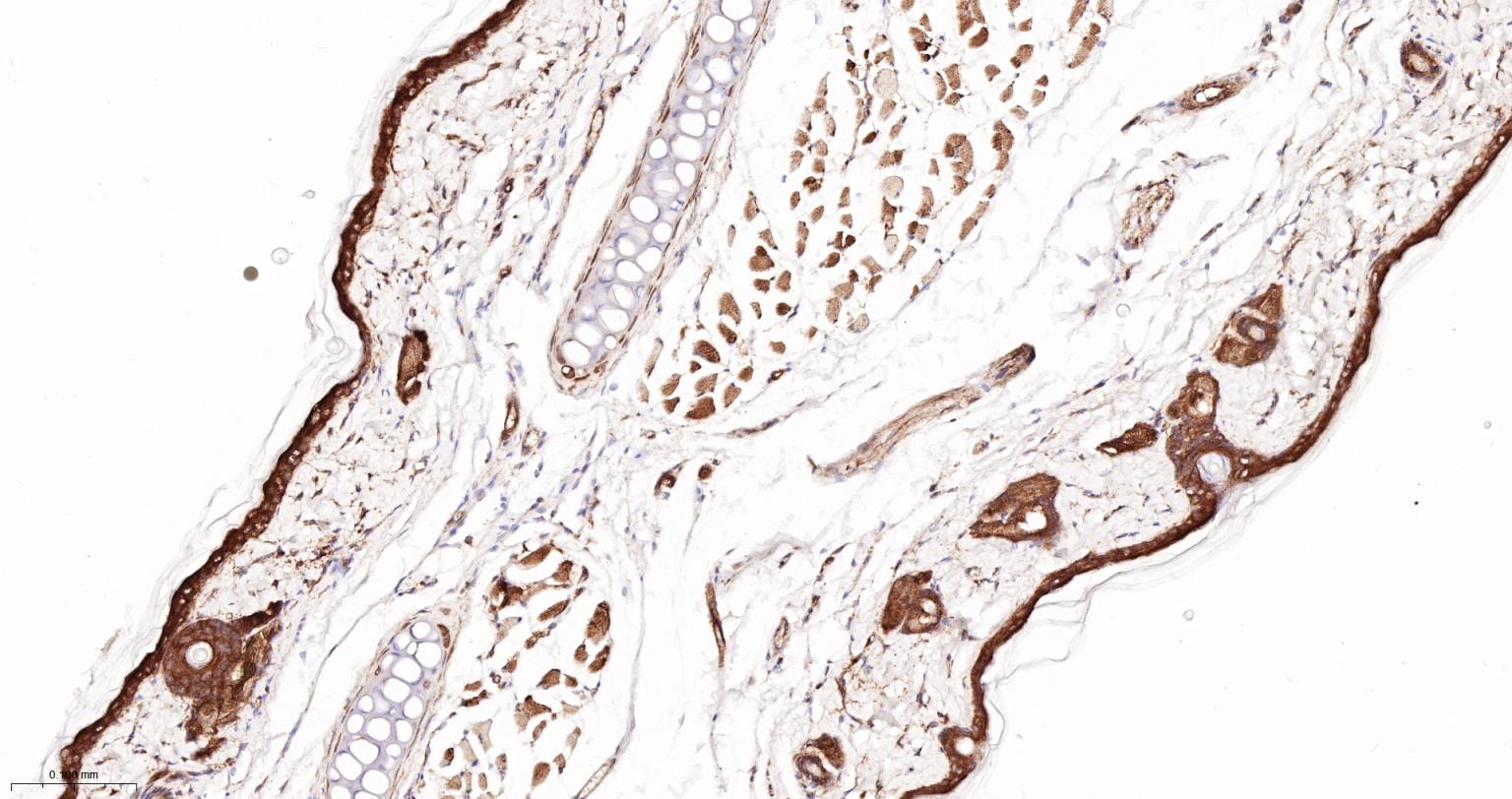 肌动蛋白相关蛋白2重组兔单抗